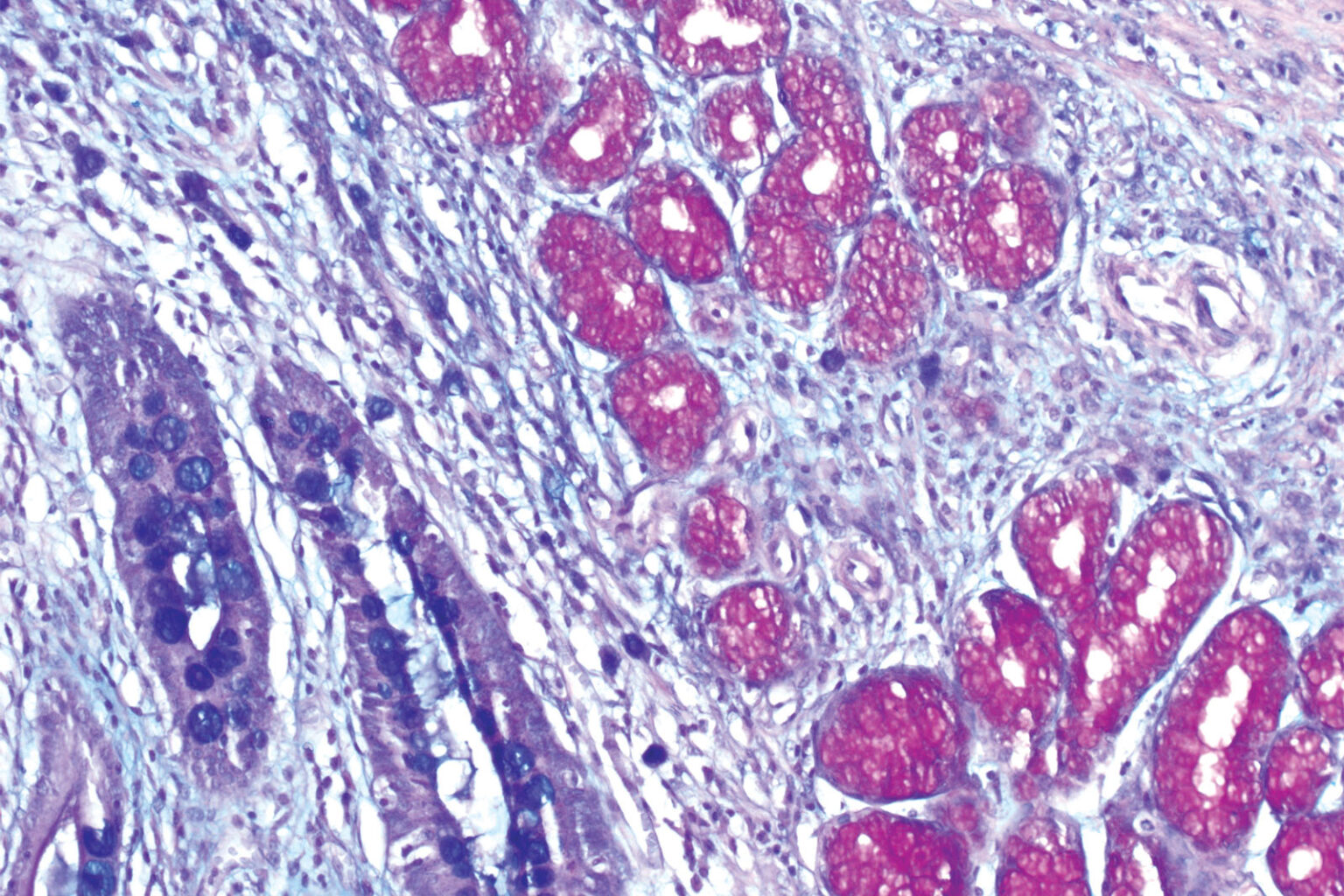 Alcian Blue - P.A.S. kit - Biognost