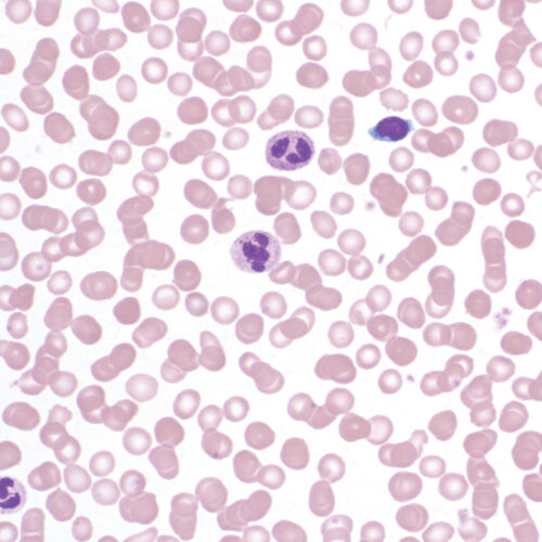 Bio-Diff RTU kit - staining