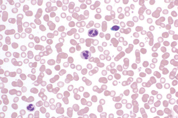 Bio-Diff RTU kit - staining