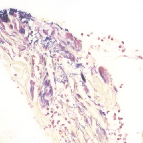 BioGram Histo kit - staining