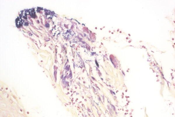 BioGram Histo kit - staining