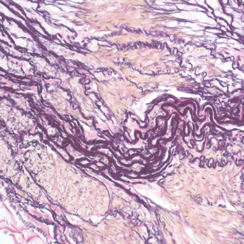 Elastica-Van Gieson kit - staining