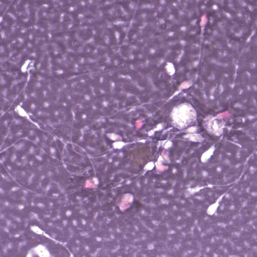 Eozin and nigrozin vital kit - staining