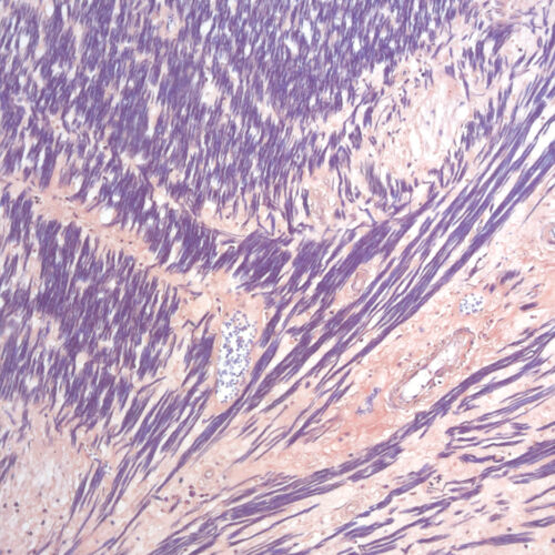 Hematoxylin P.T.A. kit - staining