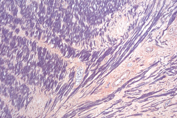 Hematoxylin P.T.A. kit - staining