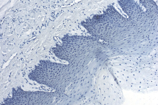 Hematoxylin W kit - staining