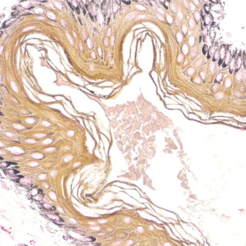 Masson Fontana kit - staining