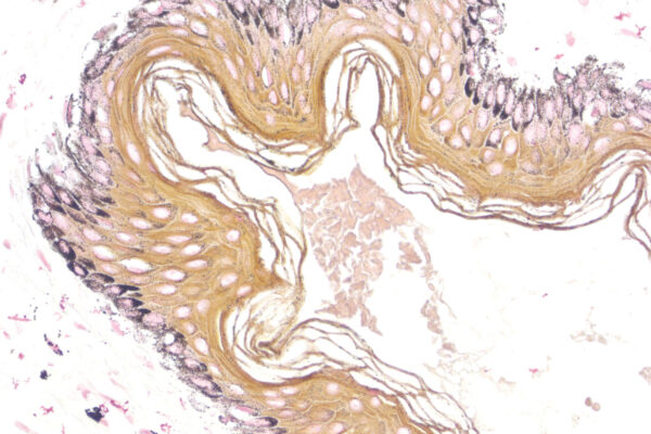 Masson Fontana kit - staining