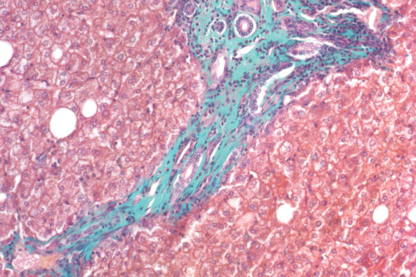 Masson-Goldner Trichrome kit - staining