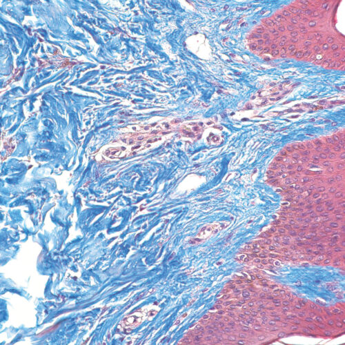 Masson Trichrome kit - staining