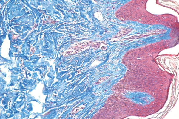 Masson Trichrome kit - staining