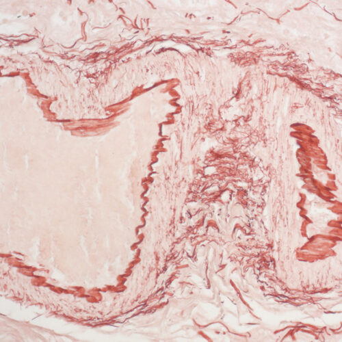 Orcein kit - staining