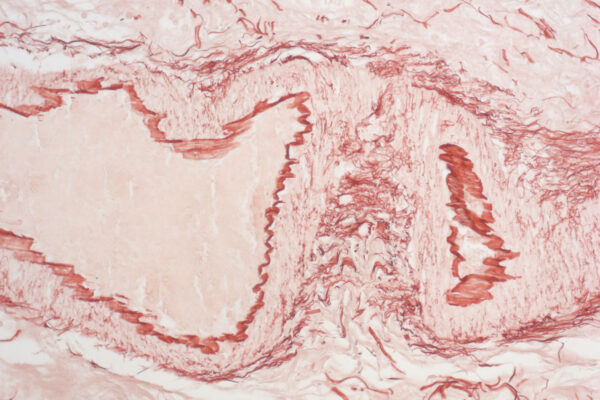 Orcein kit - staining