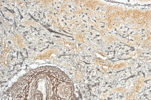 reticulin biognost solmedialtd