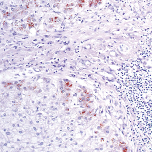 Rhodanine kit - staining