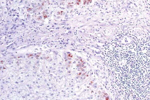 Rhodanine kit - staining