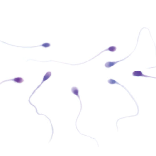 Sperm Diff RTU kit - staining