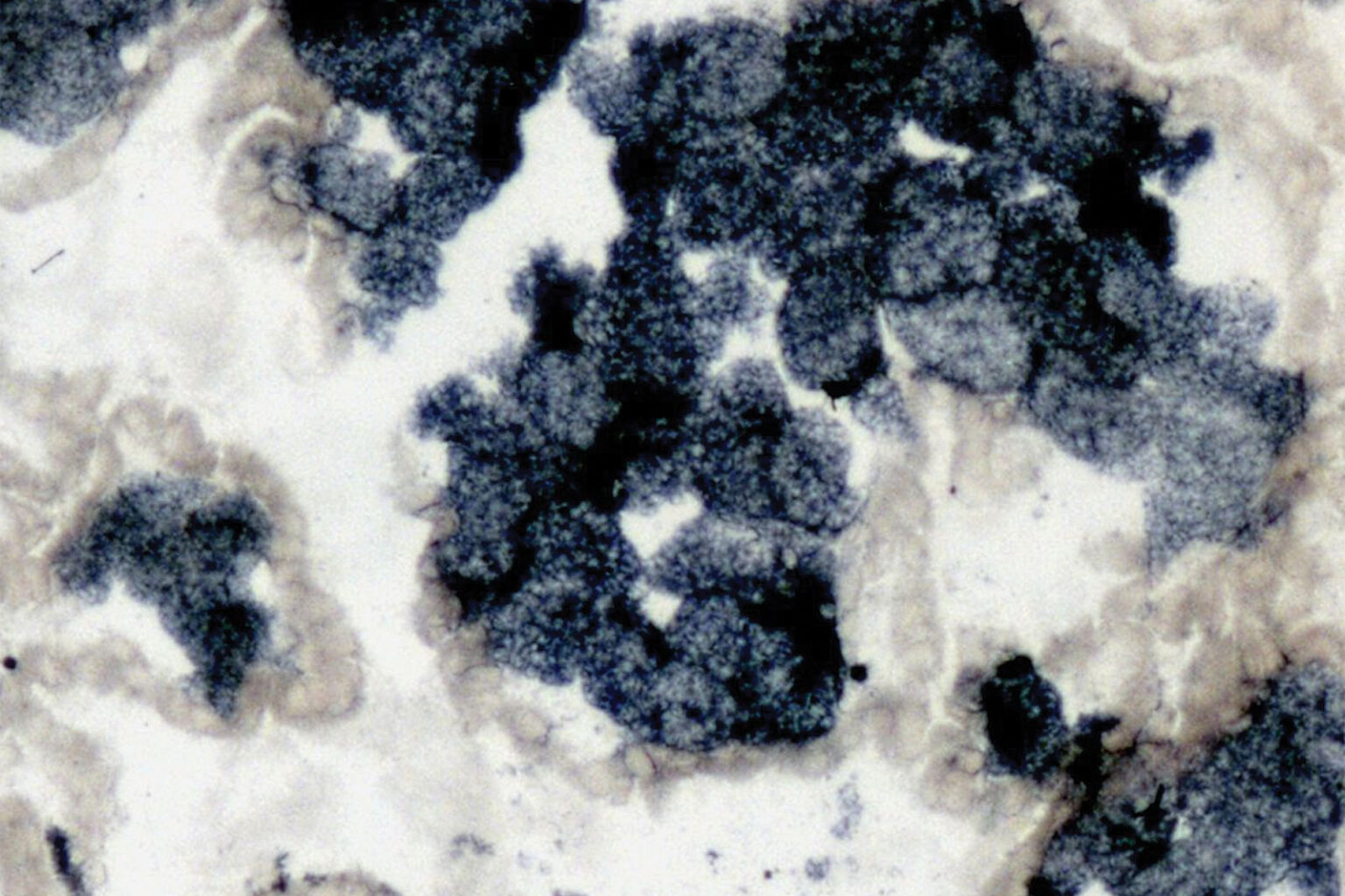 Sudan Black B Lipid kit Biognost