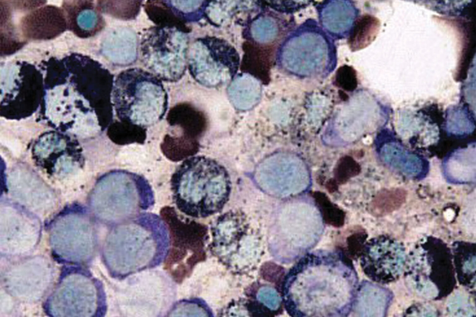 Sudan Black B kit - Biognost