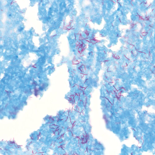 TB-Stain Histo kit - staining