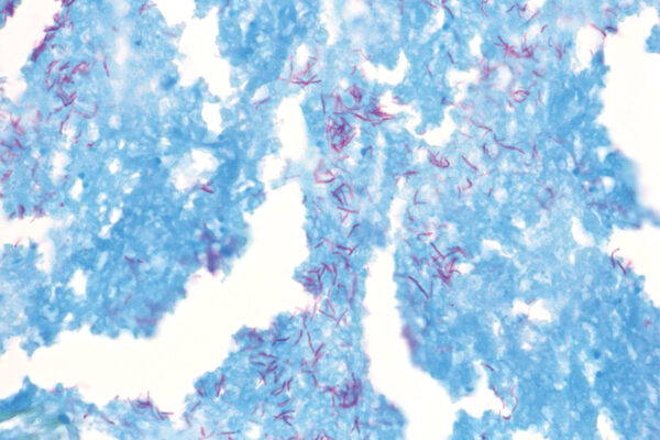 TB-Stain Histo kit - staining