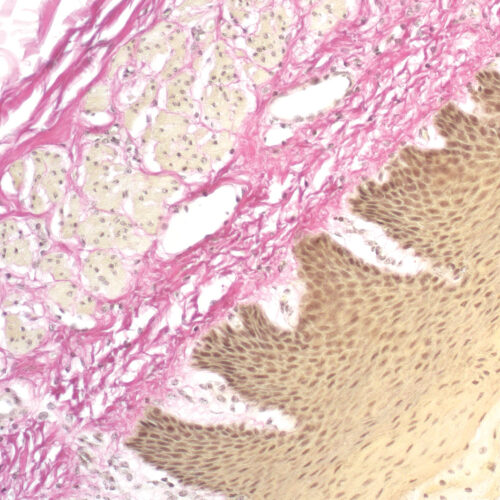 Van Gieson Trichrome kit - staining