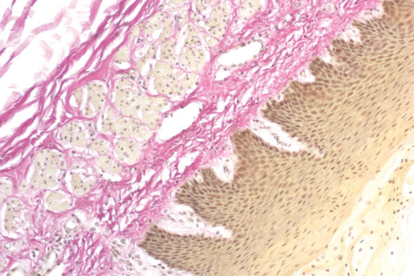 Van Gieson Trichrome kit - staining