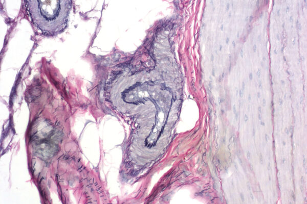 Verhoeff kit - staining