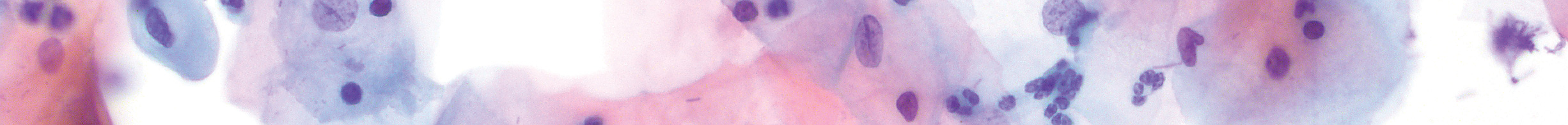 Tissue marking dye, lilac
