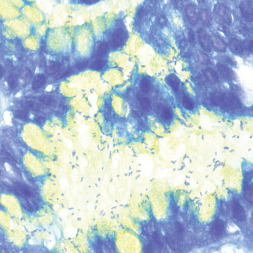 Alcian Yellow Toluidine Blue kit - staining