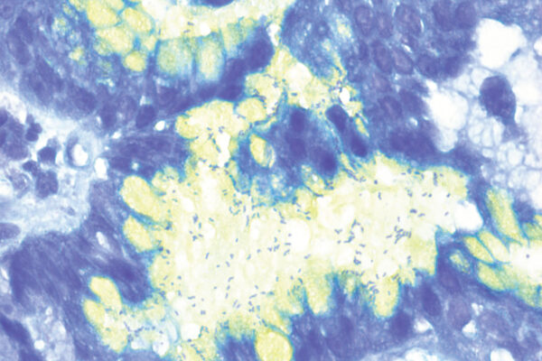 Alcian Yellow Toluidine Blue kit - staining