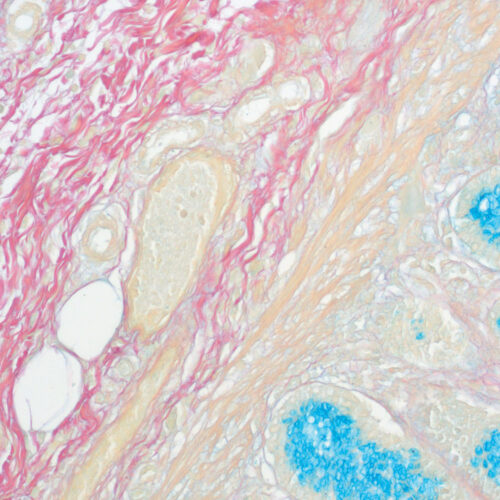 Colloidal Iron kit - staining