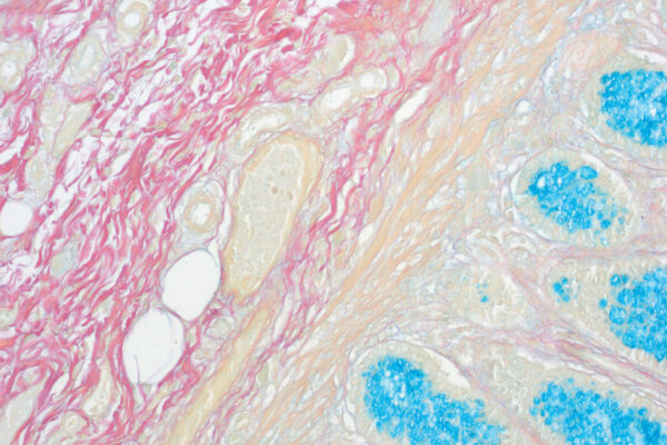 Colloidal Iron kit - staining