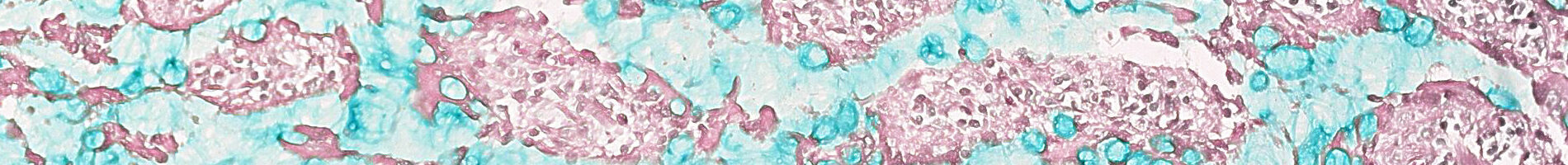 Gram stains and Ziehl-Neelsen reagents